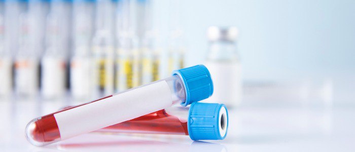 Las 5 pruebas de diagnóstico de la celiaquía